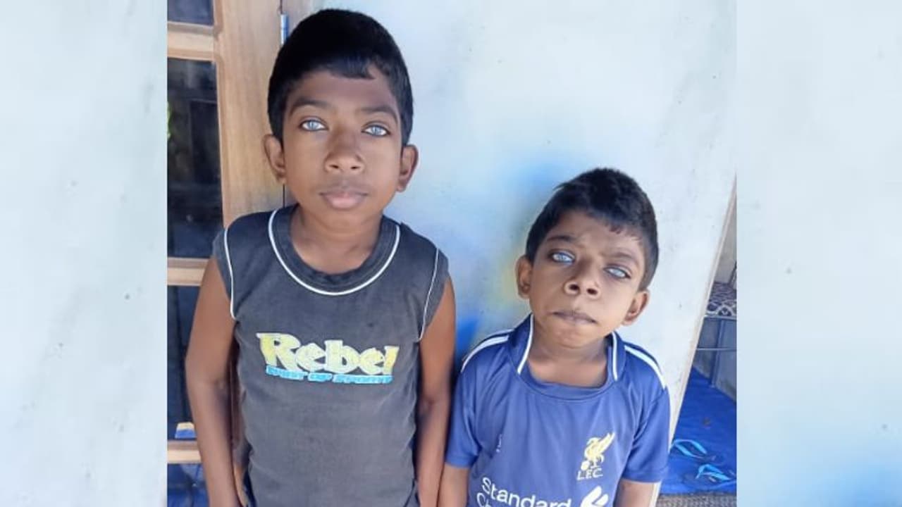 കണ്ണുകളിൽ ഇരുൾ മൂടുന്ന രോഗാവസ്ഥ; മുകോപോളിസാക്കി റിഡോസിസിൽ ചികിത്സാ സഹായം തേടി കുഞ്ഞു സഹോദരങ്ങൾ