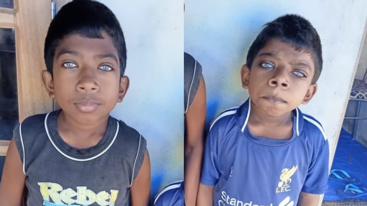 'മജ്ജ ഇല്ലാതാകുന്നു, കാഴ്ച മങ്ങി'; അസാധാരണ രോഗം, സുമനസുകളുടെ കനിവ് തേടി സഹോദരങ്ങള് 'മജ്ജ ഇല്ലാതാകുന്നു, കാഴ്ച മങ്ങി'; അസാധാരണ രോഗം, സുമനസുകളുടെ കനിവ് തേടി സഹോദരങ്ങള്