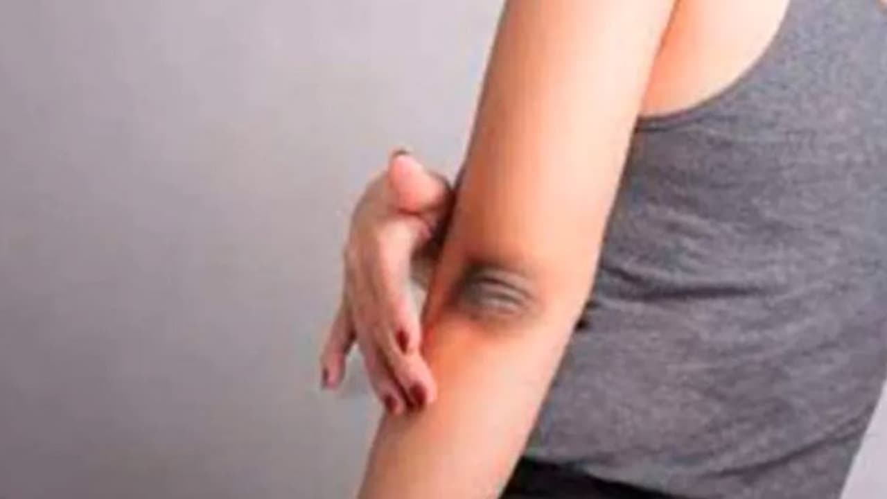 Skin Care: കൈമുട്ടിലെ കറുപ്പ് നിറം മാറാന്‍ പരീക്ഷിക്കാം ഈ ഒമ്പത് കാര്യങ്ങള്‍...