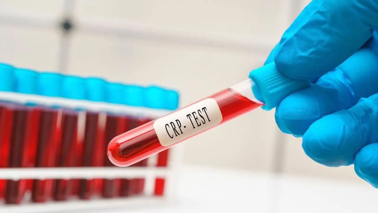 Can blood tests help in indicating a heart attack? Can it determine heart problems? Read to know more