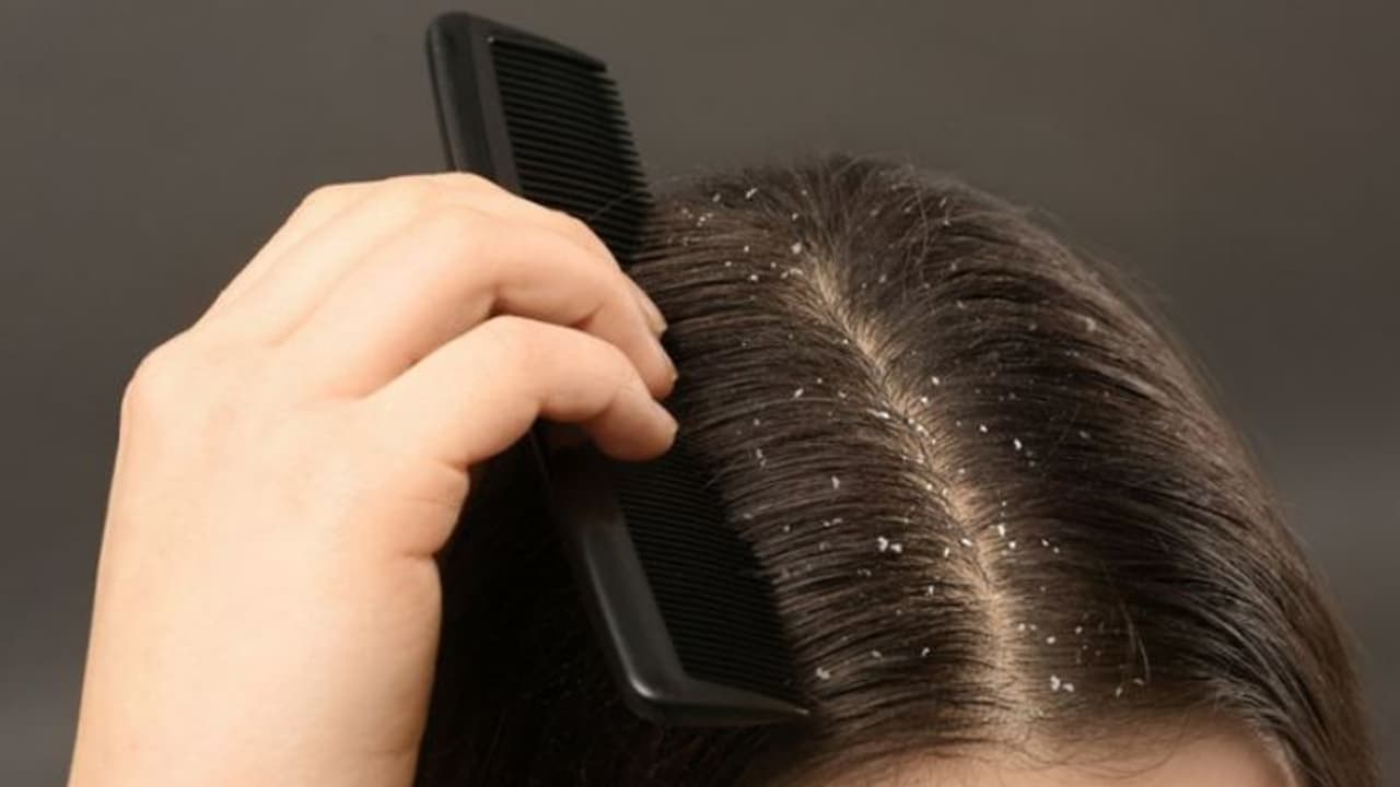 Hair Care: താരനകറ്റാനും തലമുടി വളരാനും വീട്ടിലുണ്ടാക്കാം ഈ രണ്ട് ഹെയര്‍ മാസ്കുകള്‍...