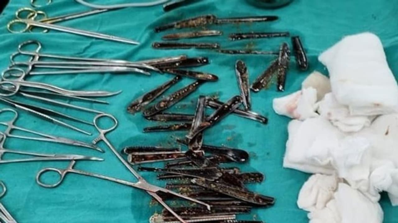 ആരോഗ്യനില വഷളായി ആശുപത്രിയിലെത്തിച്ച യുവാവിന്റെ വയറ്റില് നിന്ന് കണ്ടെത്തിയത്... ആരോഗ്യനില വഷളായി ആശുപത്രിയിലെത്തിച്ച യുവാവിന്റെ വയറ്റില് നിന്ന് കണ്ടെത്തിയത്...