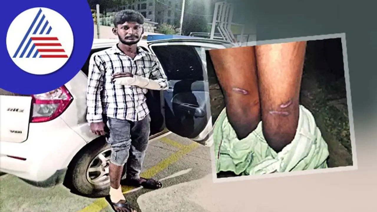ಬೆಂಗಳೂರು ಠಾಣೆಯಲ್ಲಿ ವ್ಯಕ್ತಿಗೆ ಥರ್ಡ್ ಡಿಗ್ರಿ ಟಾರ್ಚರ್, ಖಾಸಗಿ ಅಂಗಕ್ಕೆ ವಿದ್ಯುತ್ ಶಾಕ್ ನೀಡಿದ ಆರೋಪ ಬೆಂಗಳೂರು ಠಾಣೆಯಲ್ಲಿ ವ್ಯಕ್ತಿಗೆ ಥರ್ಡ್ ಡಿಗ್ರಿ ಟಾರ್ಚರ್, ಖಾಸಗಿ ಅಂಗಕ್ಕೆ ವಿದ್ಯುತ್ ಶಾಕ್ ನೀಡಿದ ಆರೋಪ