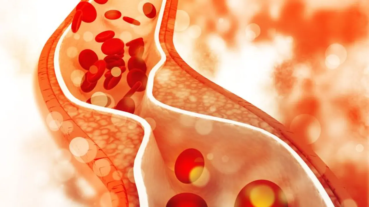 Cholesterol : മോശം കൊളസ്ട്രോൾ ഏറ്റവും കൂടുതൽ റിപ്പോർട്ട് ചെയ്തത് ഈ പ്രായക്കാരെ ; സര്‍വേ പറയുന്നത് ഇങ്ങനെ