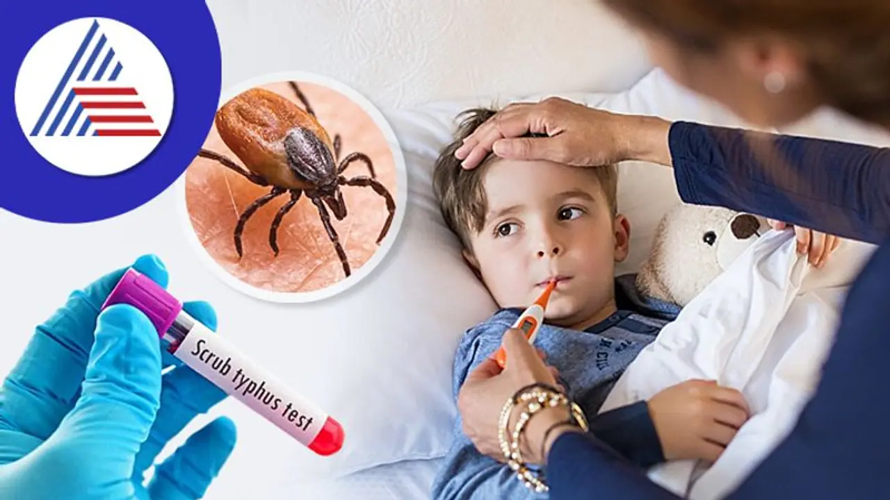ಭೀತಿ ಹುಟ್ಟಿಸಿದೆ ಡೇಂಜರಸ್ ಸ್ಕ್ರಬ್​ ಟೈಫಸ್ ಸೋಂಕು, ರೋಗ ಲಕ್ಷಣಗಳೇನು?