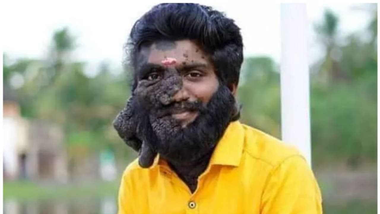 Prabhulal Prasannan : 'ആ രോഗത്തിനെ ചിരിച്ച് കൊണ്ട് നേരിട്ടു' ; പ്രഭുലാല് പ്രസന്നന് അന്തരിച്ചു Prabhulal Prasannan : 'ആ രോഗത്തിനെ ചിരിച്ച് കൊണ്ട് നേരിട്ടു' ; പ്രഭുലാല് പ്രസന്നന് അന്തരിച്ചു