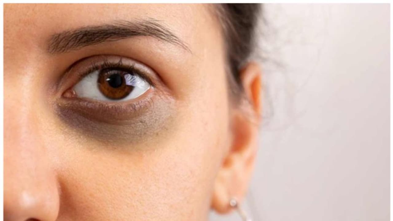 ബിപിയും കൊളസ്ട്രോളും മുതല്‍ ലൈംഗികരോഗങ്ങള്‍ വരെ കണ്ണിലൂടെ തിരിച്ചറിയാം...