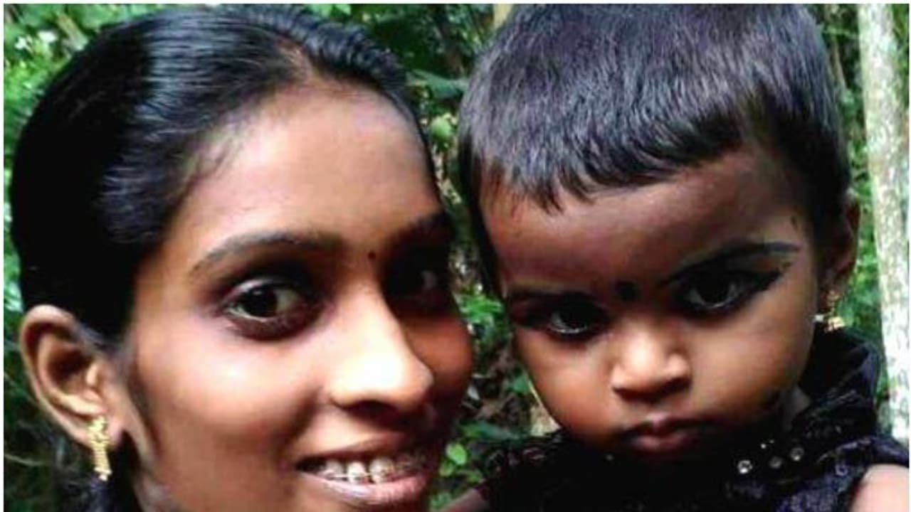 രക്തയോട്ടത്തിൽ ഓക്സിജൻ കുറവ്, ശരീരം നീല നിറമാകും; സയമോൾക്ക് ജീവൻ നിലനിർത്താൻ സഹായം വേണം, ചിലവ് 16 ലക്ഷം രക്തയോട്ടത്തിൽ ഓക്സിജൻ കുറവ്, ശരീരം നീല നിറമാകും; സയമോൾക്ക് ജീവൻ നിലനിർത്താൻ സഹായം വേണം, ചിലവ് 16 ലക്ഷം