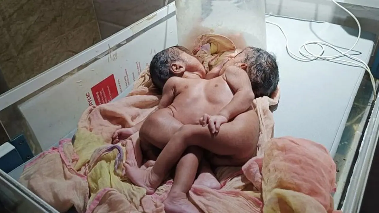 क्या है राजस्थान का अनोखा मामला, जिसे देखने के लिए लग रहा लोगों का तांता क्या है राजस्थान का अनोखा मामला, जिसे देखने के लिए लग रहा लोगों का तांता