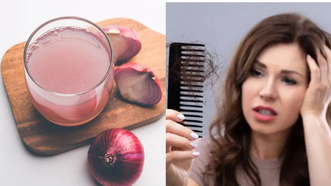 സവാള ഉപയോഗിച്ചാൽ മുടികൊഴിച്ചിൽ കുറയുമോ? സവാള ഉപയോഗിച്ചാൽ മുടികൊഴിച്ചിൽ കുറയുമോ?