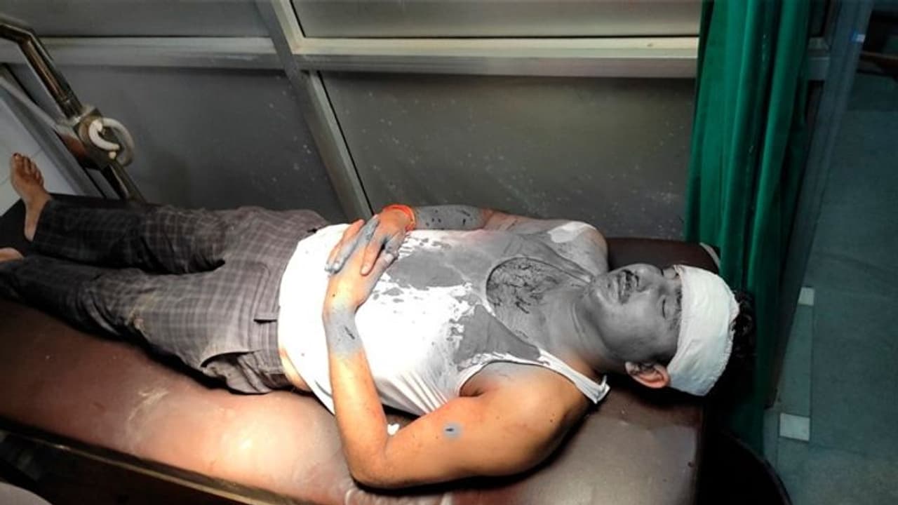 पकड़ने आई पुलिस को दी खौफनाक सजाः पहले सिर में फोड़ी शराब की बोतल, फिर भी मन नहीं भरा तो छोड़ दिया पिटबुल डॉग पकड़ने आई पुलिस को दी खौफनाक सजाः पहले सिर में फोड़ी शराब की बोतल, फिर भी मन नहीं भरा तो छोड़ दिया पिटबुल डॉग