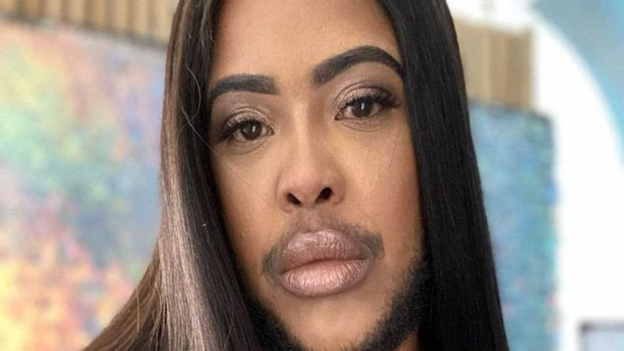 ये पुरूष नहीं महिला है, जानिए क्यों आ गई इनके चेहरे पर दाढ़ी और मूंछ 