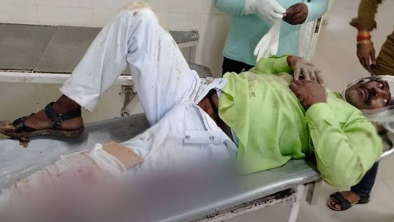 വാഹനാപകടത്തിൽ പരിക്കേറ്റയാളുടെ കാലിൽ പ്ലാസ്റ്ററിന് പകരം കാർഡ് ബോർഡ് വച്ചുകെട്ടി ആശുപത്രി