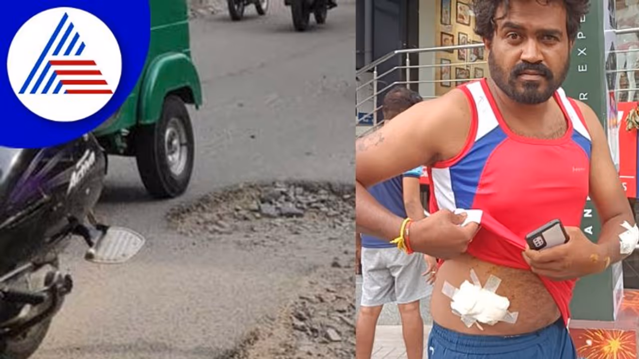 Bengaluru city: ನಗರದಲ್ಲಿ ಈಗ ರಸ್ತೆ ಗುಂಡಿಗಳದ್ದೇ ಕಾರುಬಾರು! Bengaluru city: ನಗರದಲ್ಲಿ ಈಗ ರಸ್ತೆ ಗುಂಡಿಗಳದ್ದೇ ಕಾರುಬಾರು!