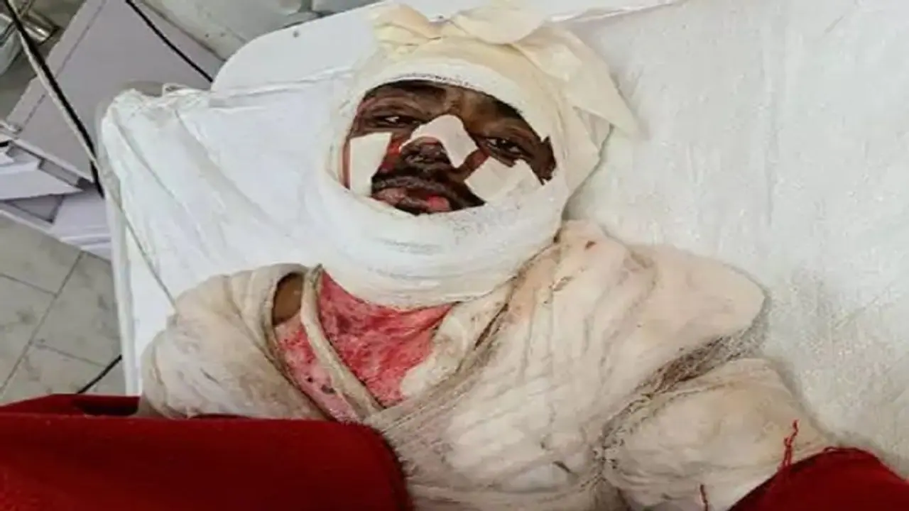 नोएडा: जमीन और रास्ते के विवाद को लेकर चचेरे भाइयों से हुआ झगड़ा, आरोपियों ने पीड़ित युवक को जिंदा जलाया नोएडा: जमीन और रास्ते के विवाद को लेकर चचेरे भाइयों से हुआ झगड़ा, आरोपियों ने पीड़ित युवक को जिंदा जलाया