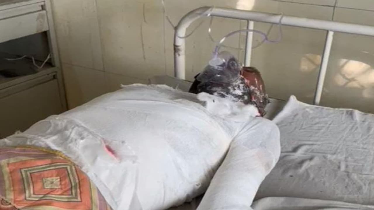 राजस्थान में फिर एक पुजारी की आत्मदाह की कोशिशः मंदिर कमेटी चेयरमैन पर लगाए गंभीर आरोप, बोले बहू के पीछे पड़ा