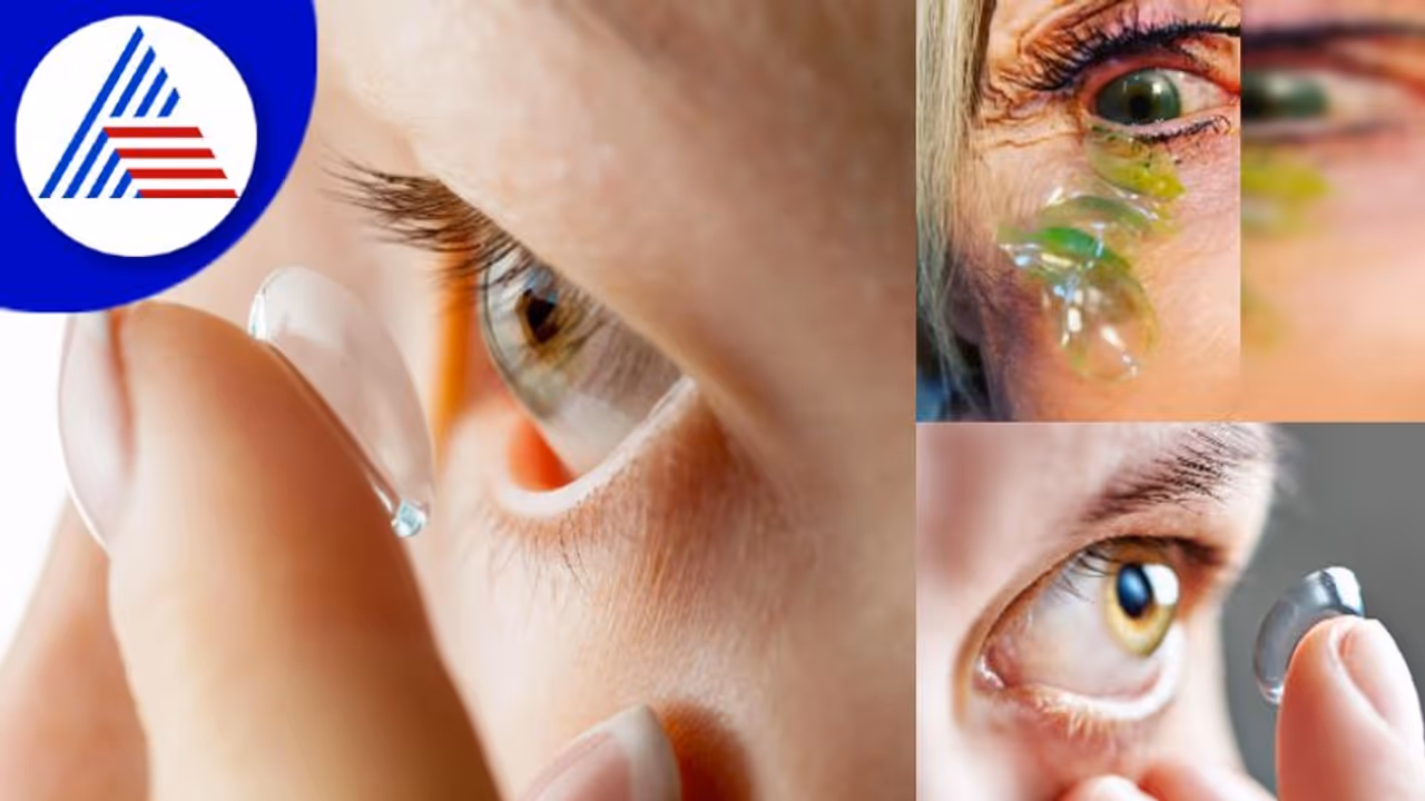 ಅಬ್ಬಬ್ಬಾ..ಇಷ್ಟೊಂದು ಮರೆವಾ? ವ್ಯಕ್ತಿಯ ಕಣ್ಣಲ್ಲಿತ್ತು ಬರೋಬ್ಬರಿ 23 ಲೆನ್ಸ್ ! ಅಬ್ಬಬ್ಬಾ..ಇಷ್ಟೊಂದು ಮರೆವಾ? ವ್ಯಕ್ತಿಯ ಕಣ್ಣಲ್ಲಿತ್ತು ಬರೋಬ್ಬರಿ 23 ಲೆನ್ಸ್ !