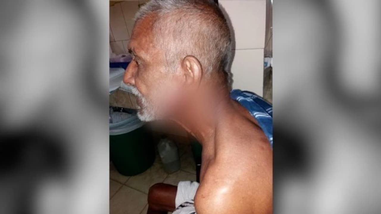 വീട്ടിൽ കയറി മൂന്നുവയസുകാരനെ കടിച്ചു, കുട്ടിയെ വാക്സിൻ എടുക്കാൻ പോയതിന് പിന്നാലെ അതേ നായ മുത്തശ്ശനെയും കടിച്ചു വീട്ടിൽ കയറി മൂന്നുവയസുകാരനെ കടിച്ചു, കുട്ടിയെ വാക്സിൻ എടുക്കാൻ പോയതിന് പിന്നാലെ അതേ നായ മുത്തശ്ശനെയും കടിച്ചു