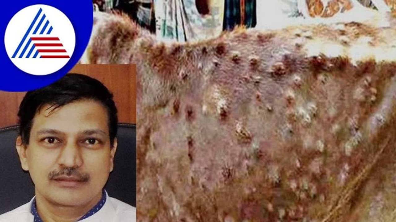 ಚರ್ಮಗಂಟು ರೋಗ: ಒಂದೇ ತಿಂಗಳಲ್ಲಿ 960 ಪ್ರಕರಣ ಪತ್ತೆ!
