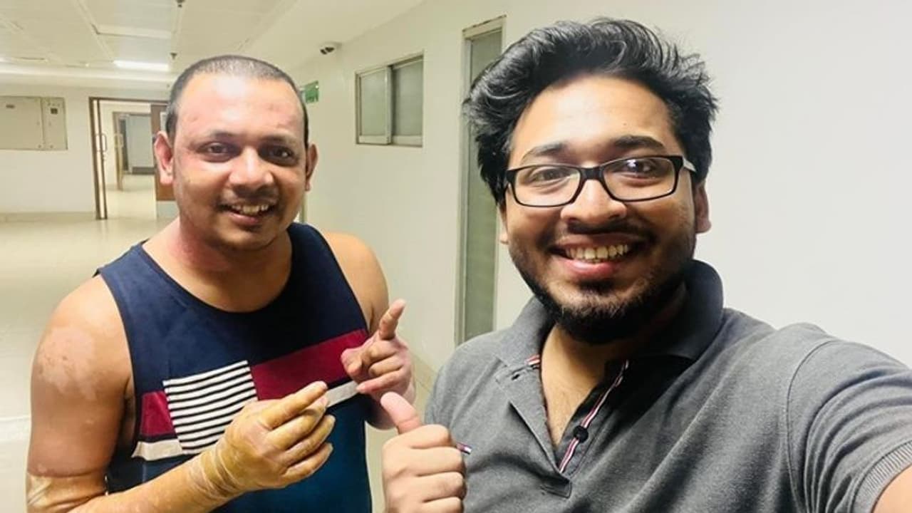 সারা গায়ে নতুন চামড়া নিয়ে নতুন জীবনে অগ্নিদগ্ধ রনি, মুখে যুদ্ধজয়ের হাসি সারা গায়ে নতুন চামড়া নিয়ে নতুন জীবনে অগ্নিদগ্ধ রনি, মুখে যুদ্ধজয়ের হাসি