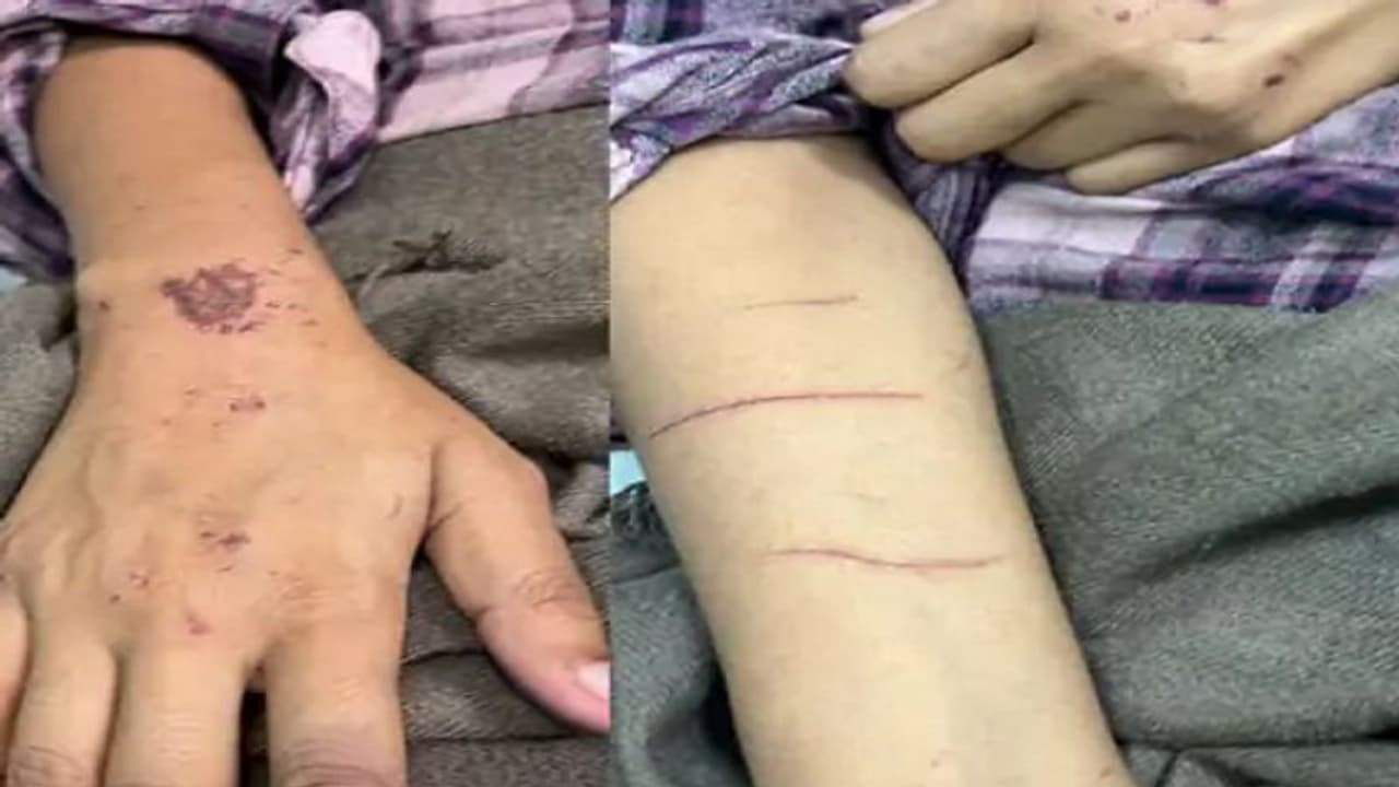 लखनऊ गैंगरेप केस: हवस मिटाने महिला टीचर को घंटों नोंचते रहे दरिंदे, जख्म देखकर भी नहीं पसीजा पुलिस का दिल लखनऊ गैंगरेप केस: हवस मिटाने महिला टीचर को घंटों नोंचते रहे दरिंदे, जख्म देखकर भी नहीं पसीजा पुलिस का दिल