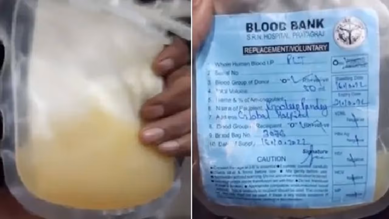 യുപിയിൽ മരിച്ച രോഗിക്ക് പ്ലാസ്മയ്ക്ക് പകരം കുത്തിവച്ചത് മുസമ്പി ജ്യൂസല്ല, കളക്ടർ റിപ്പോർട്ട് സമർപ്പിച്ചു