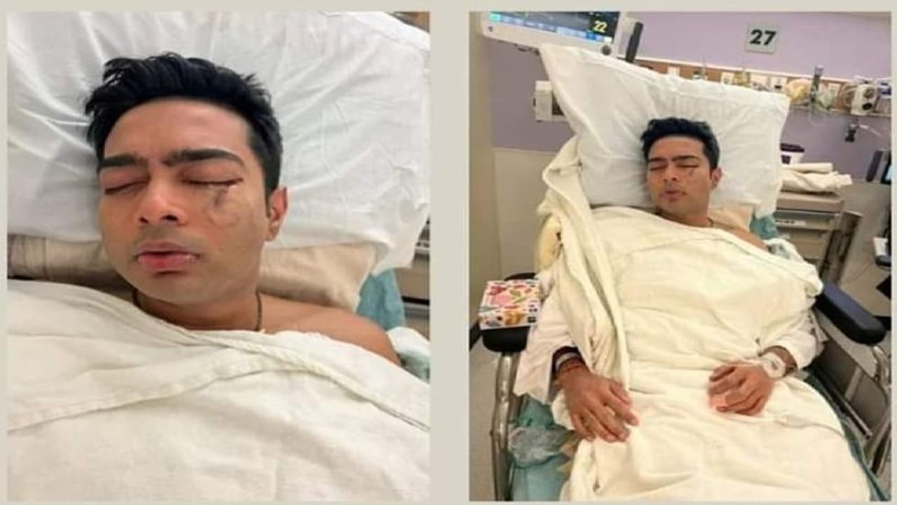 চোখের নিচে সদ্য অস্ত্রোপচারের নীল রেখা, 'সেনাপতি' অভিষেকের সুস্থতার খবরে তৃণমূল শিবিরে উচ্ছ্বাসের ঢল চোখের নিচে সদ্য অস্ত্রোপচারের নীল রেখা, 'সেনাপতি' অভিষেকের সুস্থতার খবরে তৃণমূল শিবিরে উচ্ছ্বাসের ঢল