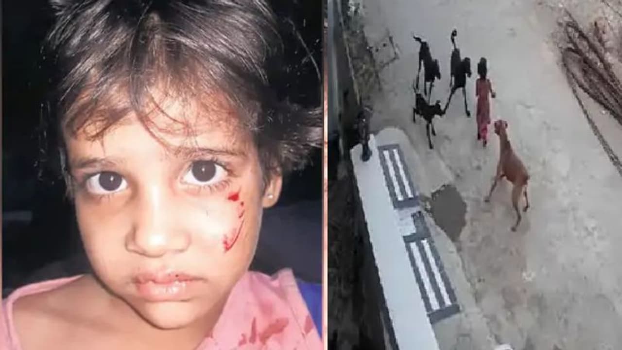 5 साल की बच्ची को कुत्ते ने नोंचकर मार डाला, इलाज से पहले डॉक्टरों ने कहा जिंदा नहीं है मासूम 5 साल की बच्ची को कुत्ते ने नोंचकर मार डाला, इलाज से पहले डॉक्टरों ने कहा जिंदा नहीं है मासूम