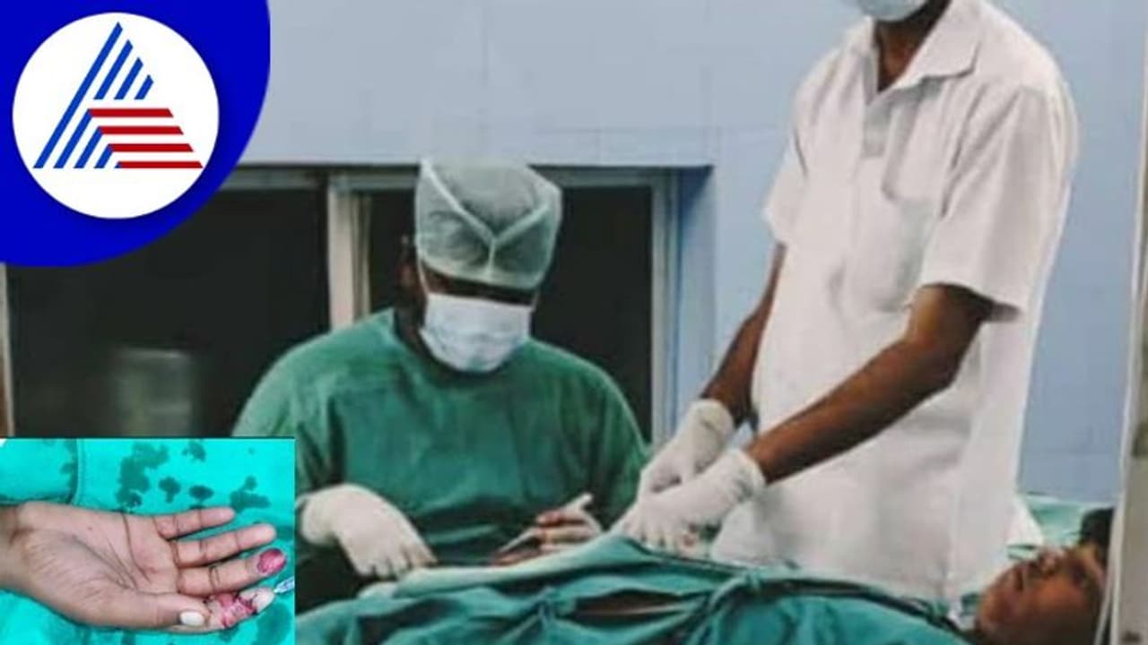 Vijayanagara: ಫ್ಯಾನ್ಗೆ ಸಿಕ್ಕಿ ತುಂಡಾದ ಬೆರಳನ್ನು ಜೋಡಿಸಿ ಮರುಜೀವ ನೀಡಿದ ವೈದ್ಯರು Vijayanagara: ಫ್ಯಾನ್ಗೆ ಸಿಕ್ಕಿ ತುಂಡಾದ ಬೆರಳನ್ನು ಜೋಡಿಸಿ ಮರುಜೀವ ನೀಡಿದ ವೈದ್ಯರು