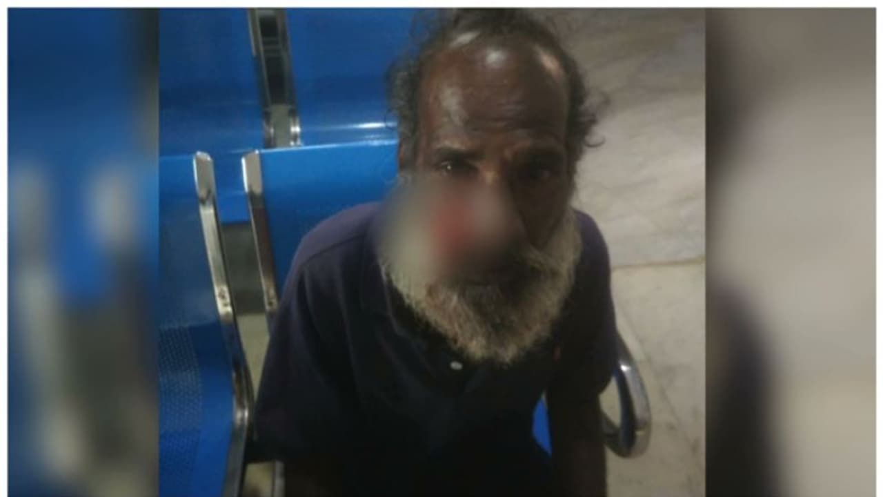 പാലക്കാട് കൊടുവായൂരിൽ തെരുവ് നായ ആക്രമണം,4പേർക്ക് കടിയേറ്റു