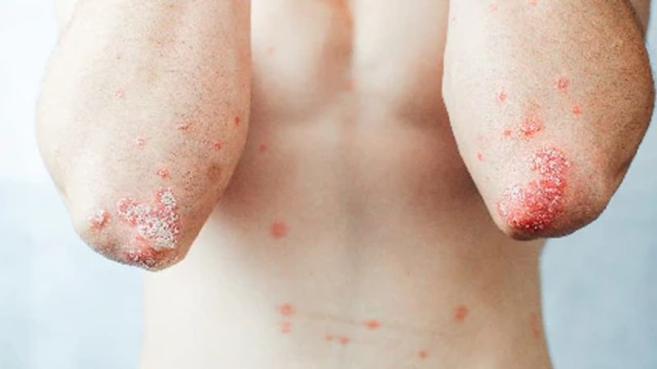 ചര്‍മ്മത്തില്‍ ഈ ലക്ഷണങ്ങള്‍ കണ്ടാല്‍ ഉടൻ ചികിത്സ തേടുക...