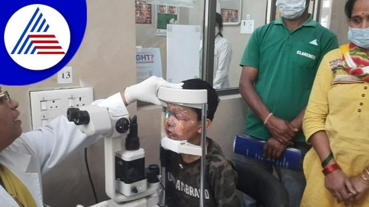 ಪಟಾಕಿ ಅವಾಂತರ, ಬೆಂಗಳೂರಿನ ವಿವಿಧೆಡೆ 9 ಮಂದಿ ಆಸ್ಪತ್ರೆಗೆ ದಾಖಲು ಪಟಾಕಿ ಅವಾಂತರ, ಬೆಂಗಳೂರಿನ ವಿವಿಧೆಡೆ 9 ಮಂದಿ ಆಸ್ಪತ್ರೆಗೆ ದಾಖಲು