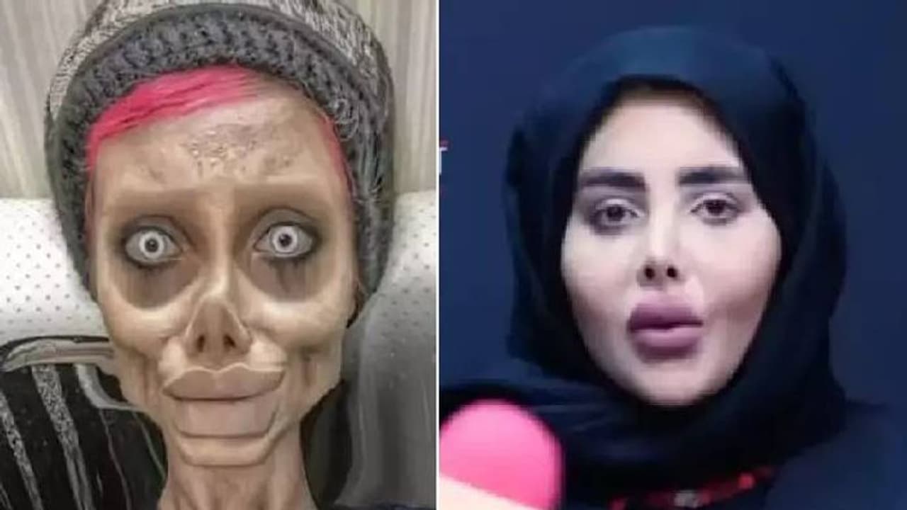 ആഞ്ചലീന ജോളിയുടെ 'സോംബി ലുക്ക്'; ഇനി ഇൻസ്റ്റഗ്രാമിലേക്കില്ല എന്ന് ഇറാനിലെ ഇൻഫ്ലുവൻസർ ആഞ്ചലീന ജോളിയുടെ 'സോംബി ലുക്ക്'; ഇനി ഇൻസ്റ്റഗ്രാമിലേക്കില്ല എന്ന് ഇറാനിലെ ഇൻഫ്ലുവൻസർ