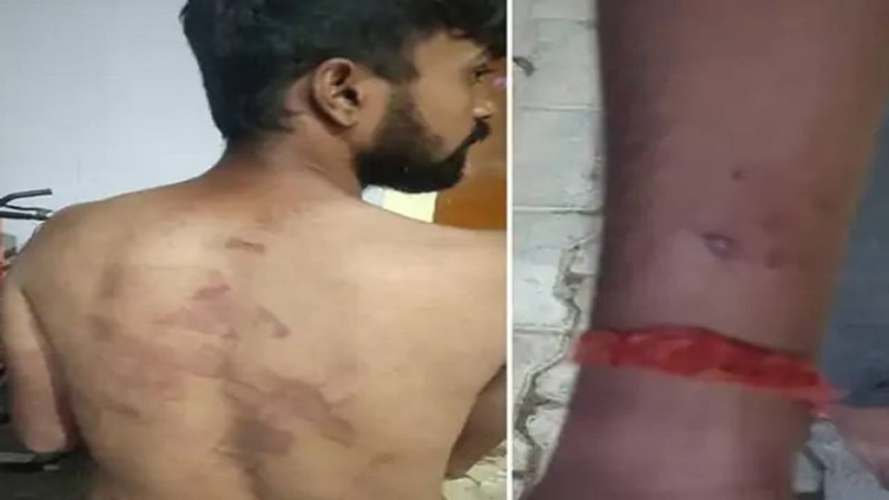 4 दिन तक बंधक बना खाते में डलवाए 40 हजार, लखनऊ से किडनैप बिहार के युवक ने बताई पूरी कहानी 4 दिन तक बंधक बना खाते में डलवाए 40 हजार, लखनऊ से किडनैप बिहार के युवक ने बताई पूरी कहानी