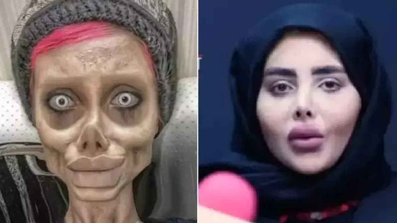 ആഞ്ജലീന ജോളിയാകാൻ പ്ലാസ്റ്റിക് സര്‍ജറി ചെയ്തെന്ന് പ്രചരിപ്പിച്ചതിന് ജയിലിലായ യുവതിക്ക് മോചനം