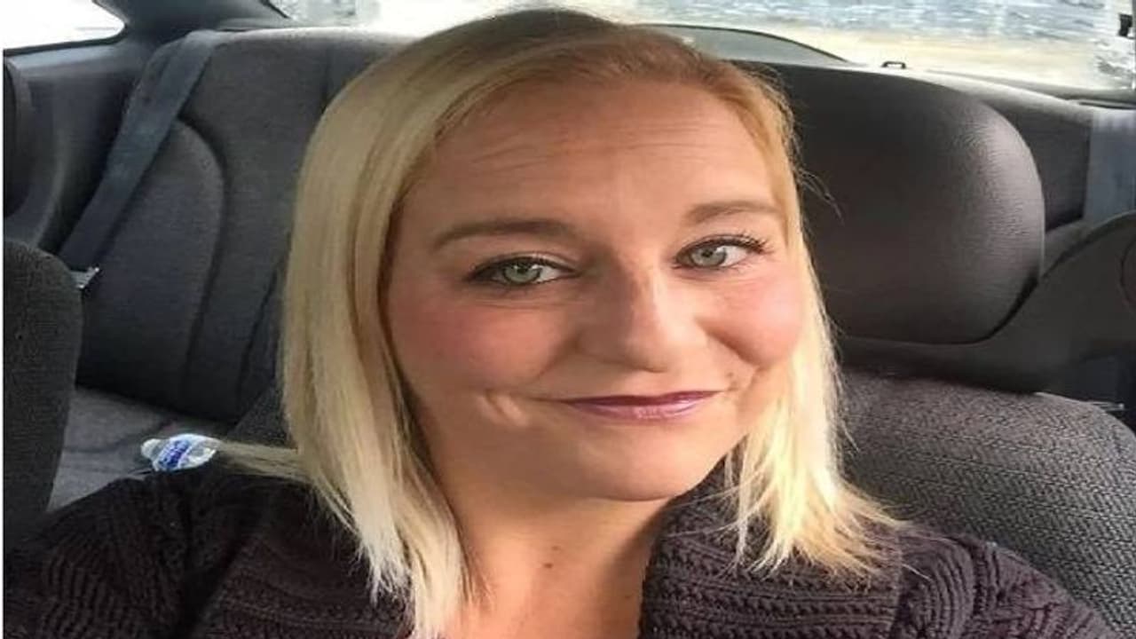 ഉടമയെ കടിച്ചുകീറി പിറ്റ്ബുൾ, നൂറിലധികം തുന്നലുകൾ, അഞ്ച് ഓപ്പറേഷനുകൾ, ജീവൻ രക്ഷപ്പെട്ടത് കഷ്ടി ഉടമയെ കടിച്ചുകീറി പിറ്റ്ബുൾ, നൂറിലധികം തുന്നലുകൾ, അഞ്ച് ഓപ്പറേഷനുകൾ, ജീവൻ രക്ഷപ്പെട്ടത് കഷ്ടി