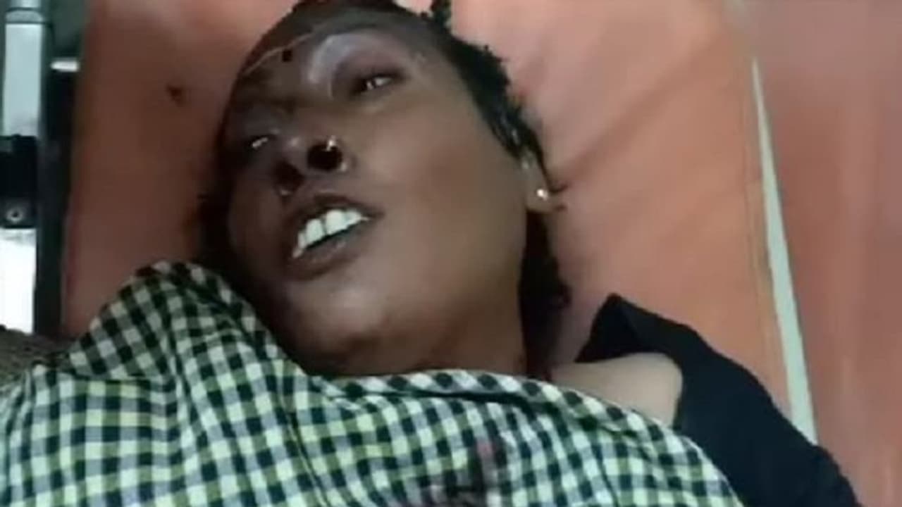 सीतापुर: पहले पत्नी का काटा गला, फिर पेट्रोल डालकर की जिंदा जलाने की कोशिश, पीड़िता ने पति पर लगाए गंभीर आरोप