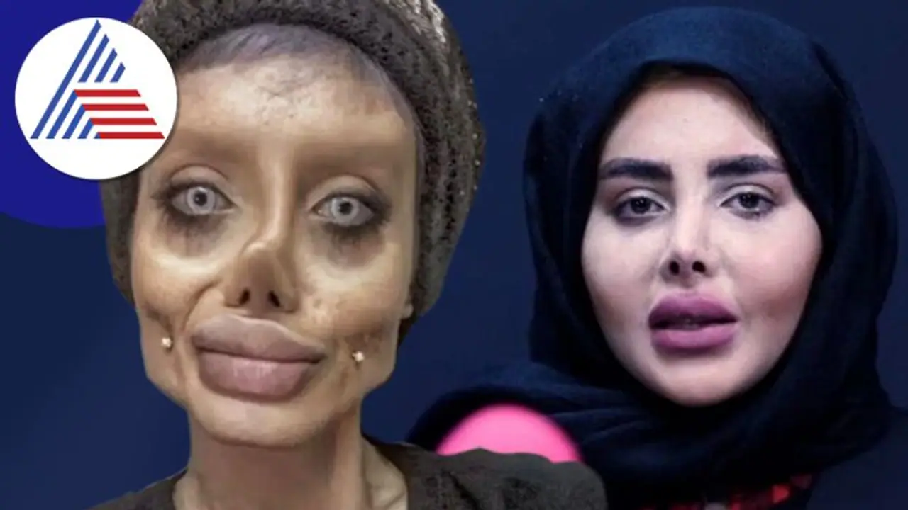 ಜೈಲಿಗೆ ಹೋಗಿ ಬಂದ ಬಳಿಕ ಅಸಲಿ ಮುಖ ಬಹಿರಂಗಪಡಿಸಿದ Zombie Angelina Jolie ಜೈಲಿಗೆ ಹೋಗಿ ಬಂದ ಬಳಿಕ ಅಸಲಿ ಮುಖ ಬಹಿರಂಗಪಡಿಸಿದ Zombie Angelina Jolie