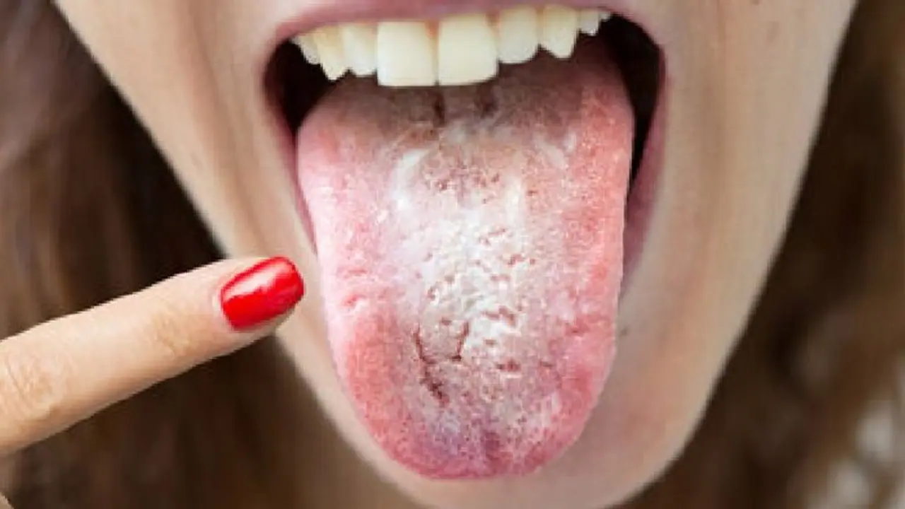 നാവില്‍ ഈ മാറ്റങ്ങള്‍ കണ്ടാല്‍ ശ്രദ്ധിക്കണേ; പരിശോധനയും നടത്താം...