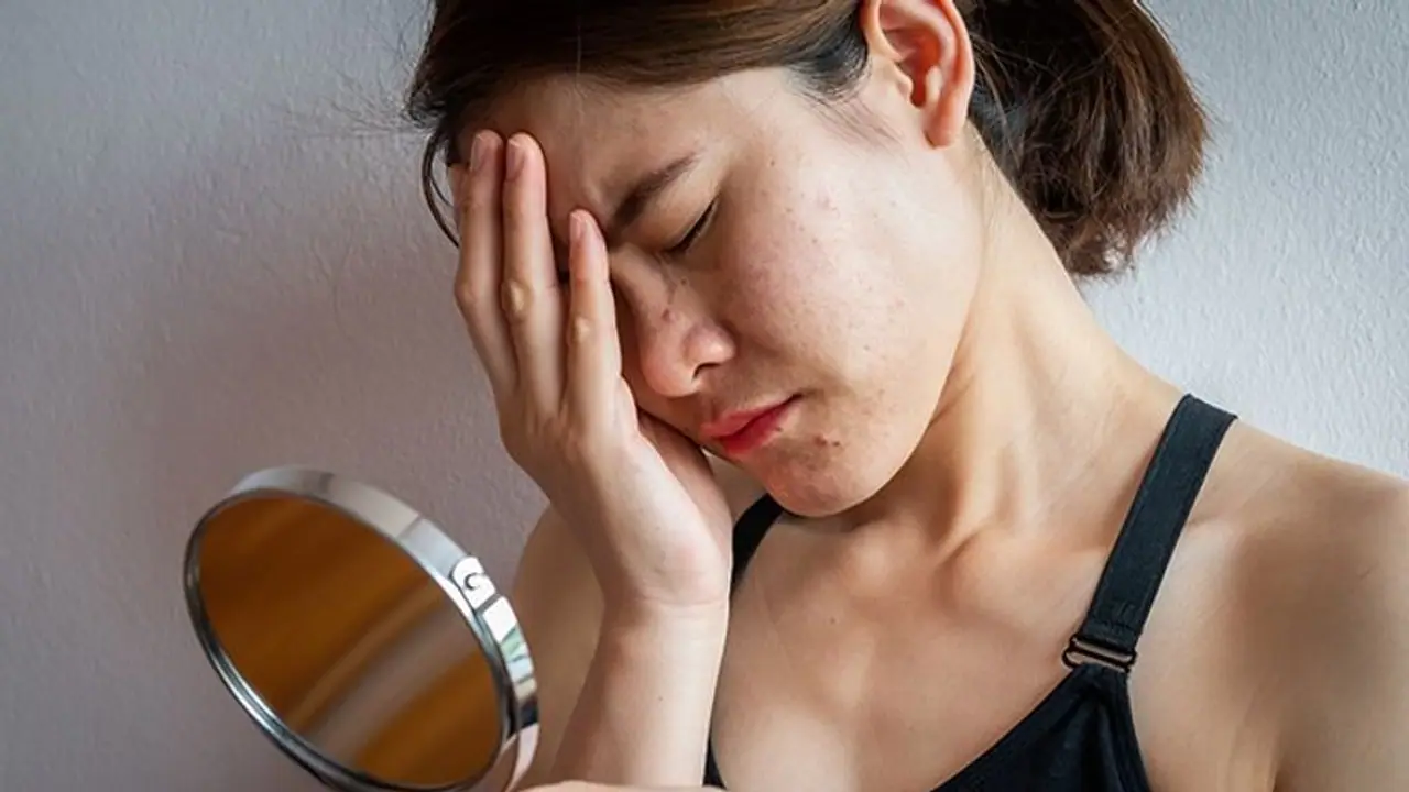 Want to get rid of dark circles? Try these easy homemade face masks Want to get rid of dark circles? Try these easy homemade face masks