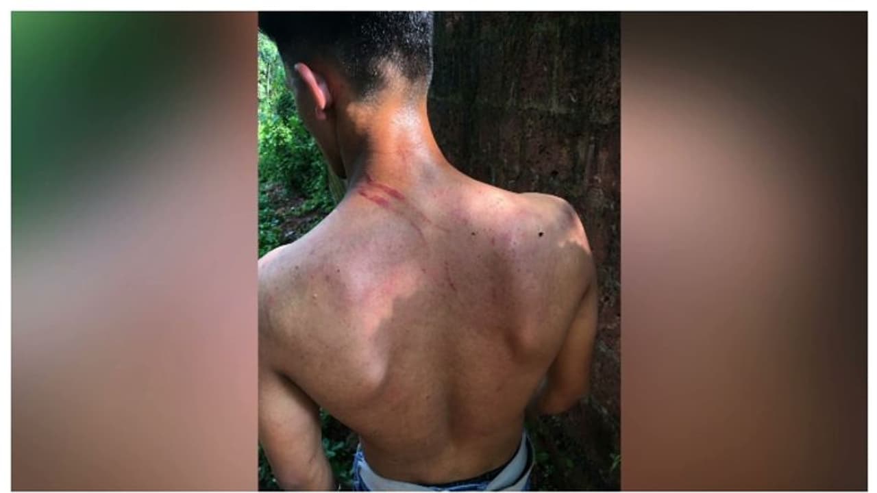 കോഴിക്കോട് നാദാപുരത്ത് ക്രൂര റാഗിംഗ്, വിദ്യാര്ത്ഥിയുടെ ഇടത് ചെവിയുടെ കര്ണപുടം തകര്ന്നതായി പരാതി കോഴിക്കോട് നാദാപുരത്ത് ക്രൂര റാഗിംഗ്, വിദ്യാര്ത്ഥിയുടെ ഇടത് ചെവിയുടെ കര്ണപുടം തകര്ന്നതായി പരാതി