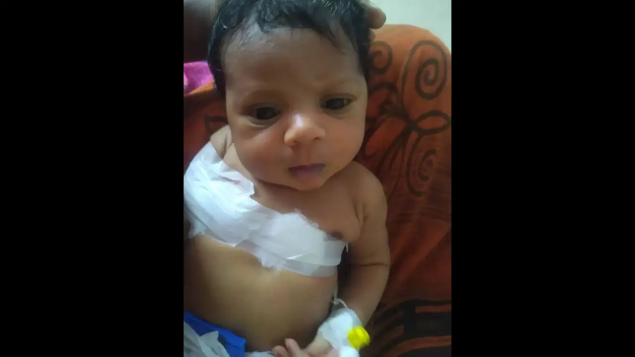 பிறந்த குழந்தைக்கு எலும்பு முறிவு.. செவிலியர் பிரசவம் பார்த்ததால் விபரீதம்..? ஓசூர் அருகே அதிர்ச்சி.. பிறந்த குழந்தைக்கு எலும்பு முறிவு.. செவிலியர் பிரசவம் பார்த்ததால் விபரீதம்..? ஓசூர் அருகே அதிர்ச்சி..