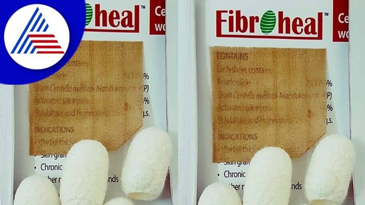 ಗಾಯ ವಾಸಿ ಮಾಡಲಿದೆ ರೇಷ್ಮೆಗೂಡು ಪ್ಲಾಸ್ಟರ್! ಗಾಯ ವಾಸಿ ಮಾಡಲಿದೆ ರೇಷ್ಮೆಗೂಡು ಪ್ಲಾಸ್ಟರ್!