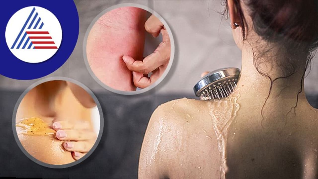 ಕೊಳೆ ಹೋಗ್ಲಿ ಅಂತ ಮೈ ತಿಕ್ಕಿ ತಿಕ್ಕಿ ಸ್ನಾನ ಮಾಡ್ತೀರಾ ? ಚರ್ಮದಲ್ಲಿ ಕಲೆಯಾಗುತ್ತೆ ಹುಷಾರ್ 