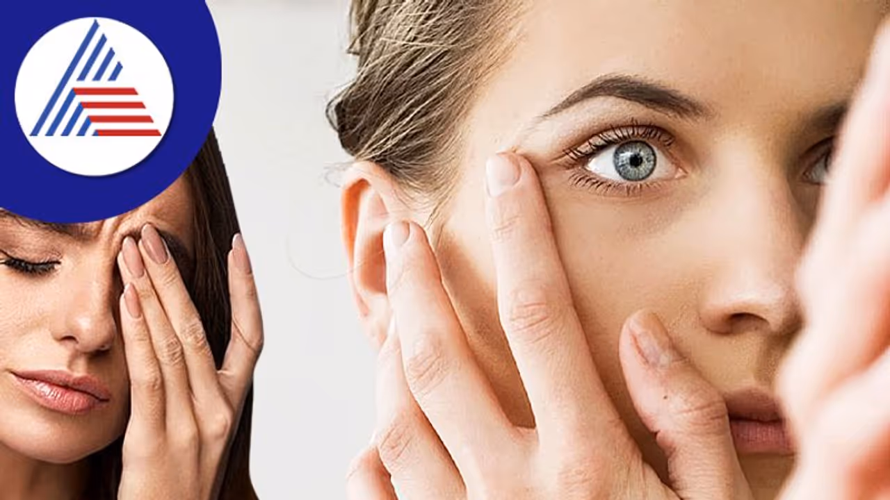 Eye Twitching: ಇದು ಕಣ್ಣ ನೋಟದ ಮಾತು: ಕಣ್ಣುಗಳು ಯಾವಾಗ ಮಿಟುಕುತ್ತವೆ? 