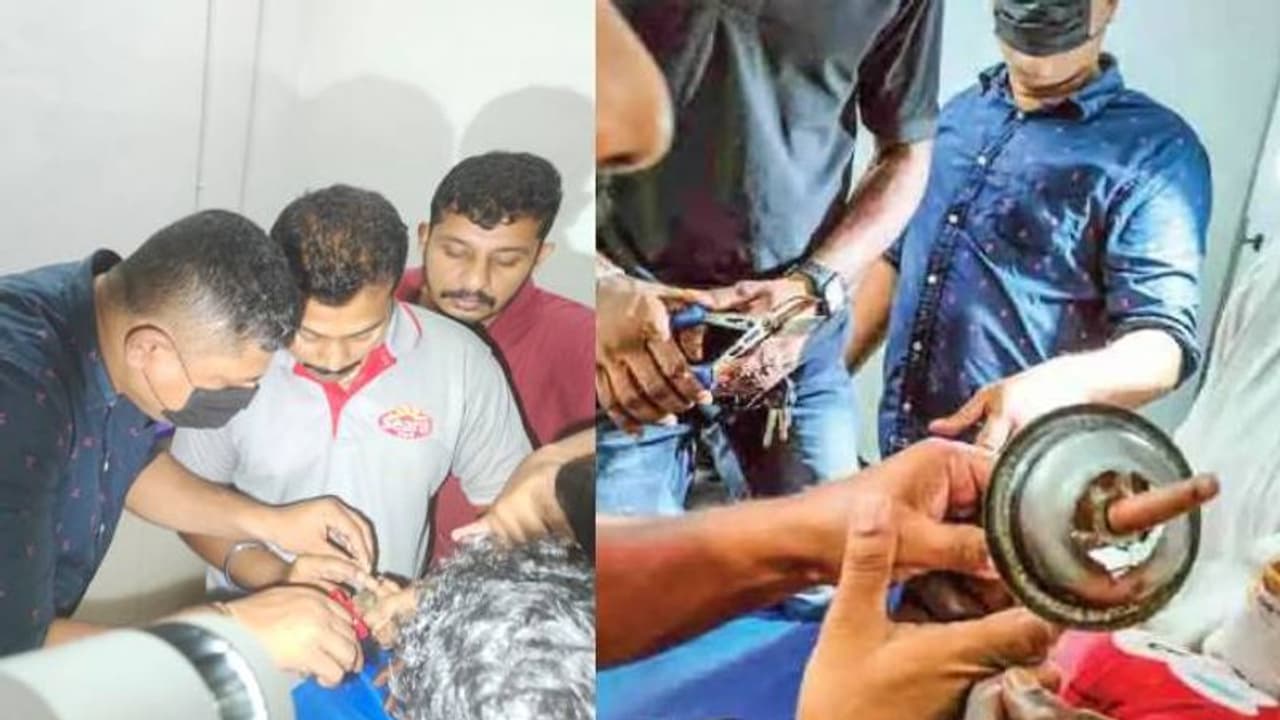 ആറുവയസുകാരിയുടെ വിരൽ കപ്ലിങ്ങിൽ കുടുങ്ങി; രക്ഷകരായി ഇ ആർ എഫ് 