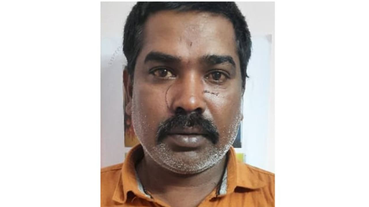 കുടുംബ വഴക്ക് തീര്പ്പാക്കാനെത്തി; ഭാര്യാ പിതാവിനെയും അളിയനെയും ചുറ്റികയ്ക്ക് അടിച്ചയാള് അറസ്റ്റില് കുടുംബ വഴക്ക് തീര്പ്പാക്കാനെത്തി; ഭാര്യാ പിതാവിനെയും അളിയനെയും ചുറ്റികയ്ക്ക് അടിച്ചയാള് അറസ്റ്റില്