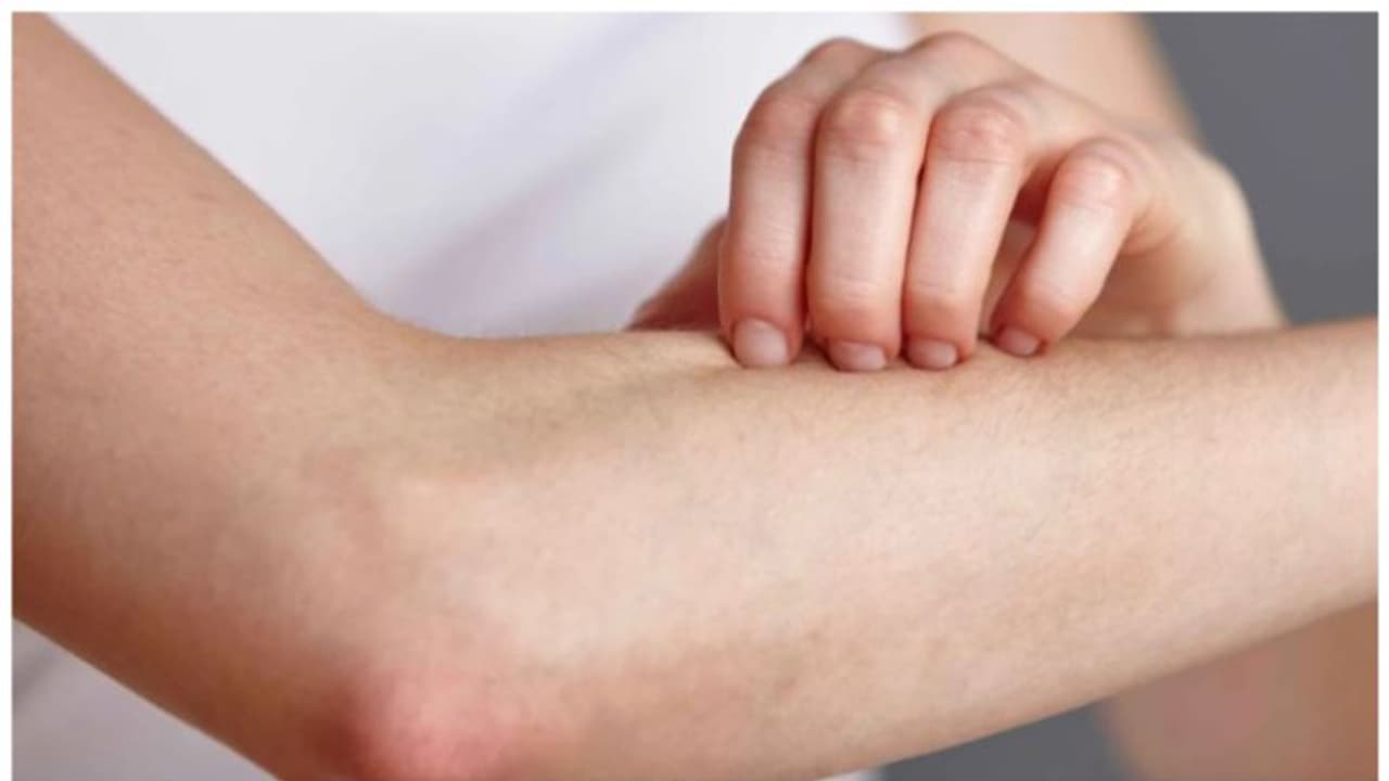 ഈ പോഷകത്തിന്റെ കുറവ് ചർമ്മപ്രശ്നങ്ങൾക്ക് കാരണമാകും 