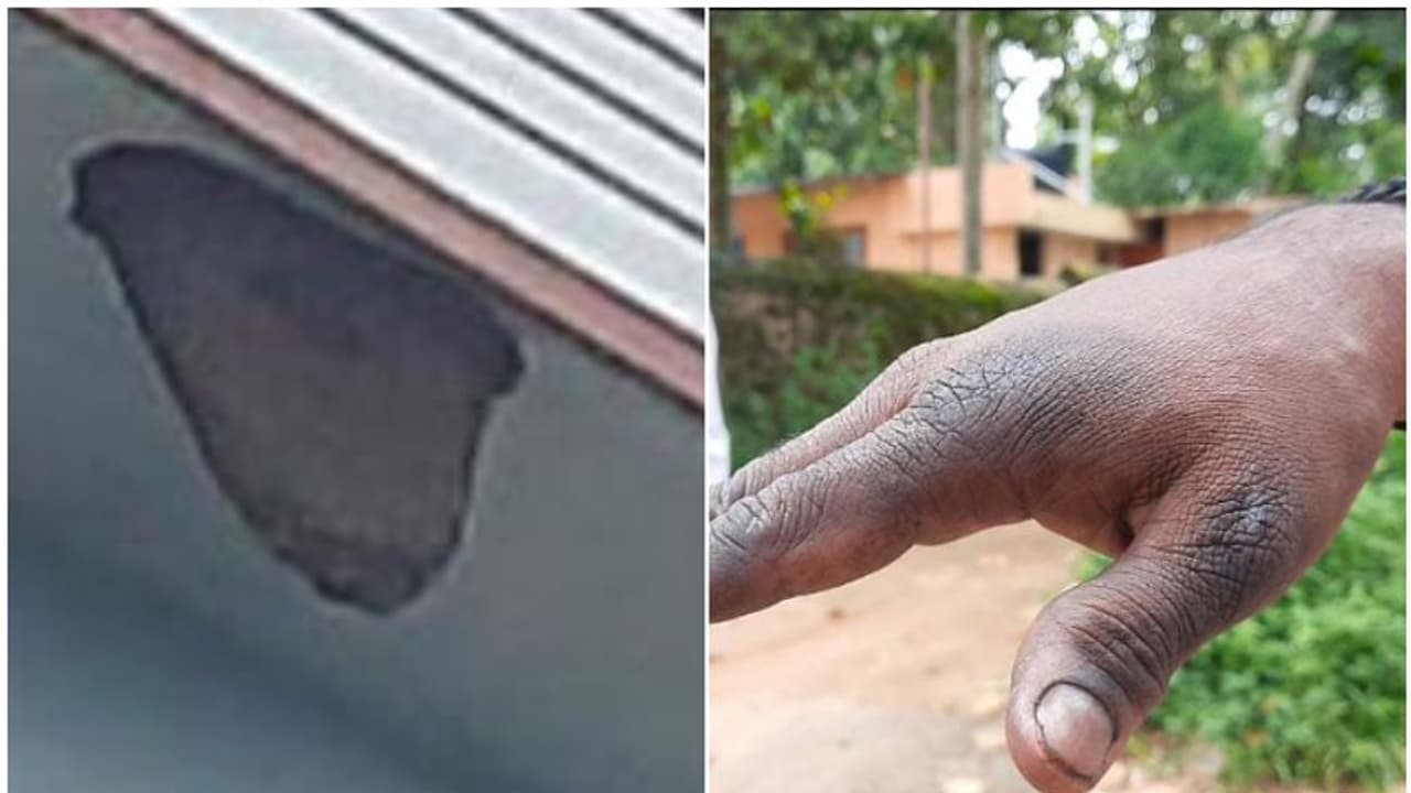 കൂറ്റൻ വാട്ടർടാങ്കിൽ വമ്പൻ തേനീച്ചക്കൂട്, ആക്രമണത്തിൽ നിരവധിപേർ ചികിത്സയിൽ, ഭയത്തോടെ തലസ്ഥാനത്തെ ഒരു പ്രദേശം