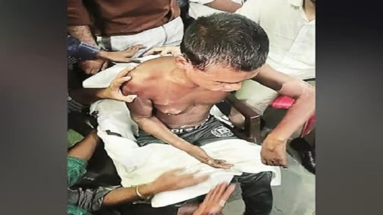 कानपुर भिखारी गैंग: 'साहब यही लोग है' आरोपियों की आवाज सुन ताजा हुए सुरेश मांझी के 6 माह के दर्द कानपुर भिखारी गैंग: 'साहब यही लोग है' आरोपियों की आवाज सुन ताजा हुए सुरेश मांझी के 6 माह के दर्द